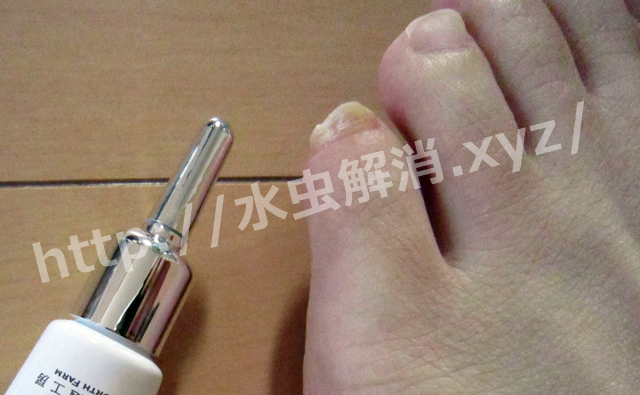 爪水虫とクリアネイルショット1